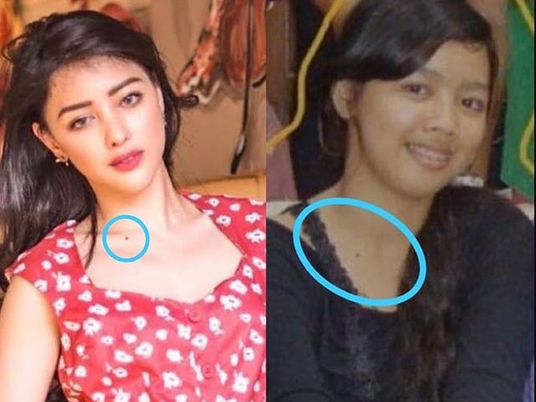 Siwi Sidi Purwanto Siwi Widi Purwanto memiliki paras yang beda banget usai lakukan operasi plastik. Yuk, intip potret transformasinya!