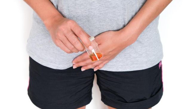 Hepatitis akut ditandai oleh sejumlah gejala. Beberapa di antaranya dapat dilihat dari warna air urine dan feses.