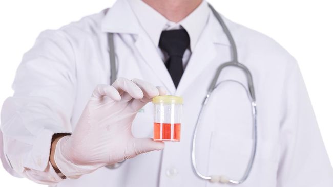 Warna urine bisa berubah seiring dengan kebiasaan dan kondisi kesehatan seseorang. Berikut beberapa warna urine dan artinya yang perlu diketahui.