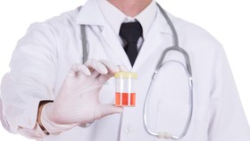 9 Warna Urine dan Artinya, Bisa Jadi Penyakit Serius