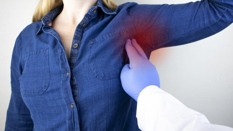 mastitis Breast Cancer Prevention Concept. A woman suffers from pain in the armpit. Sweating, unpleasant odor, redness, tooth and inflammation in the armpit.