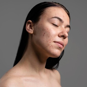 img-title BeauPicks: 3 Rangkaian Produk Skincare dari Brand Lokal untuk Merawat Kulit Sensitif