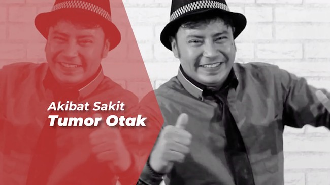 Pedangdut Senior Jacky Hasan Meninggal Dunia, Elvy Sukaesih Berduka