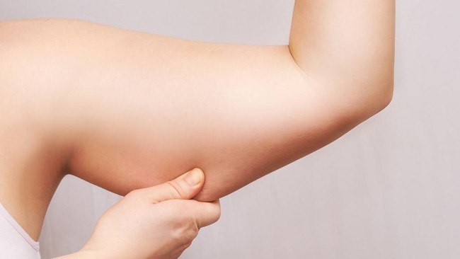 Anda mungkin mendapati beberapa bagian kulit tubuh yang mengendur setelah menurunkan berat badan. Berikut tips mengencangkan kulit kendur.