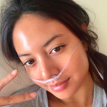 Pakai Selang Oksigen, Aurelie Moeremans Diduga Terpapar COVID-19