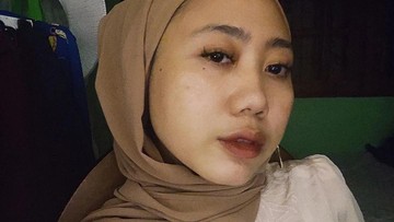 TAK DAPAT DUKUNGAN DARI PERSONEL AMIGDALA LAINNYA