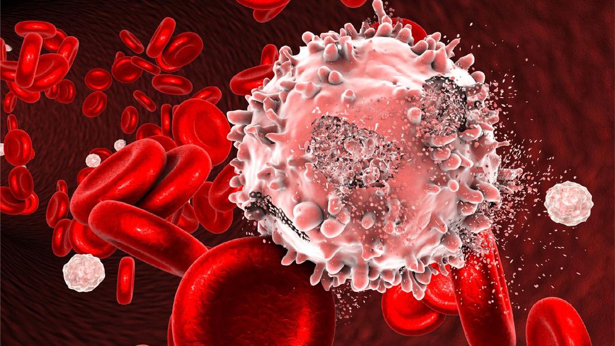 Mengenal Multiple Myeloma, Kanker Darah yang Sering Terlambat Disadari