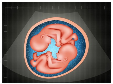 Tahap Perkembangan Janin Kembar di Trimester 1, Bunda Perlu Tahu