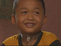 Cerita Sedih Rafli Tak Lagi Sekolah Usai Leher Bolong Gegara Ditendang Sapi