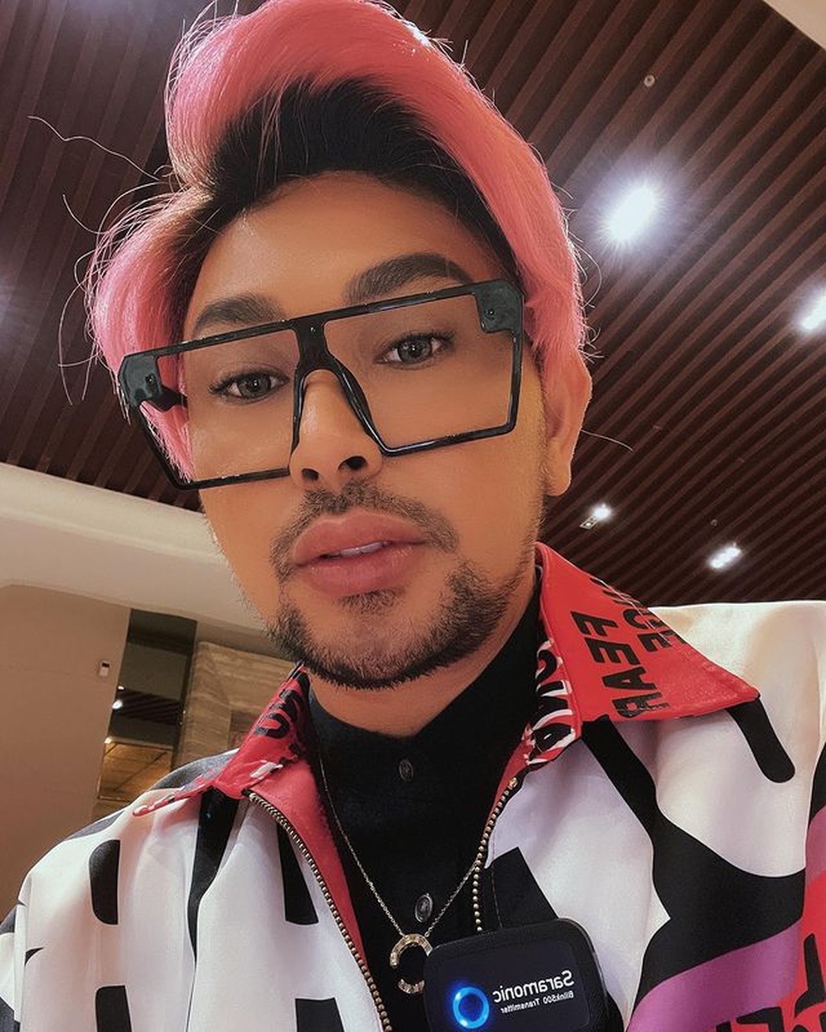 Potret Caren Delano yang Disebut Tiru Bibir Ivan Gunawan