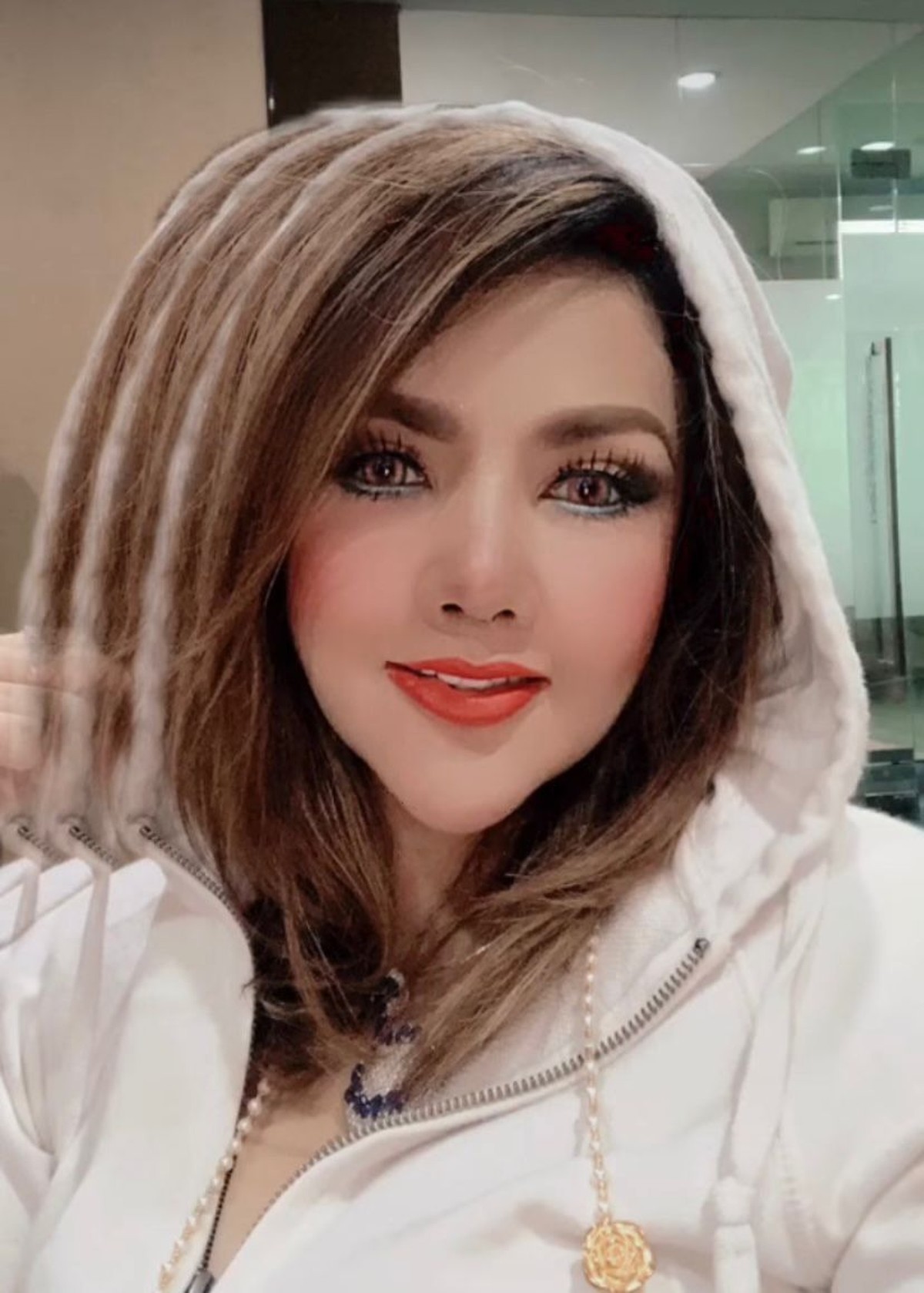 Barbie Kumalasari baru saja melakukan operasi hidung dan habiskan uang sebanyak Rp50 juta&period; Yuk&comma; intip potretnya&excl;