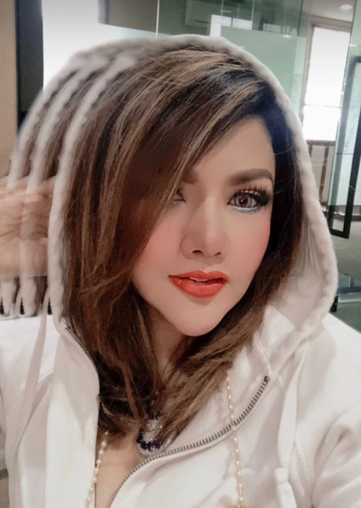 Barbie Kumalasari baru saja melakukan operasi hidung dan habiskan uang sebanyak Rp50 juta&period; Yuk&comma; intip potretnya&excl;