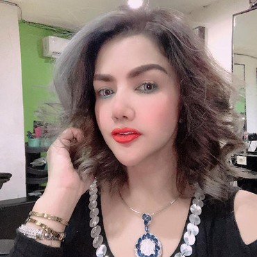 7 Penampakan Barbie Kumalasari Usai Operasi Hidung Rp50 Juta