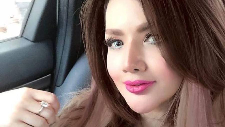 Barbie Kumalasari baru saja melakukan operasi hidung dan habiskan uang sebanyak Rp50 juta. Yuk, intip potretnya!
