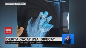 VIDEO: Viral Pekerja Kehilangan Empat Jari Tangan Kemudian di PHK