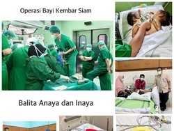 Operasi Pemisahan Bayi Dempet Dada-Perut di RSU Soetomo Butuh Waktu 9 Jam