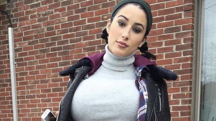 Terobsesi Kurus, Model Asal Kanada Ini Cuma Makan Cheetos dan Jalani Operasi Ratusan Kali