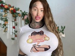 Selebgram Keranjingan Oplas, Organ Intim hingga Hidung Barbie