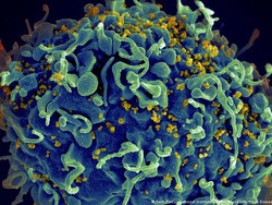 Pasien Ketiga HIV Berhasil Sembuh Berkat Terapi Sel Punca