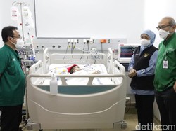 Khofifah Jenguk Balita Kembar Siam yang Berhasil Dioperasi RSU dr Soetomo