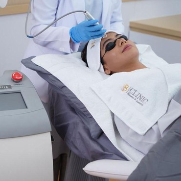 Laser Glass Skin Perawatan 20 Menit Wajah Glowing tanpa Downtime