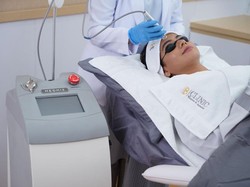 Laser Glass Skin Perawatan 20 Menit Wajah Glowing tanpa Downtime