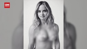 VIDEO: Model Sindrom Down Pertama di Sejarah Victoria's Secret