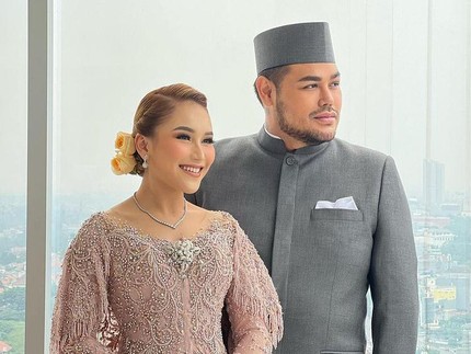 Ivan Gunawan Bikin Pangling di Pernikahan Adik Ayu Ting Ting, Terlihat Lebih Kurus