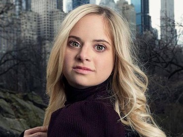 img-title 7 Potret Cantik Sofia Jirau, Model Down Syndrome Pertama Victoria's Secret