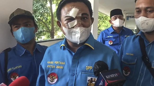Polisi menetapkan politikus Golkar, Azis Samual ditetapkan sebagai tersangka kasus pengeroyokan terhadap Ketua Umum DPP KNPI Haris Pertama.