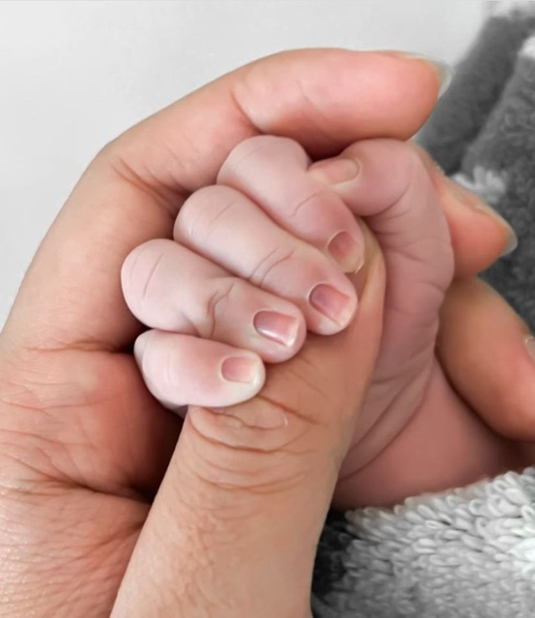 Momen Lahiran Aurel Hermansyah Atta Halilintar dan Aurel Hermansyah telah dikaruniai anak pertama pada Selasa (22/2). Yuk, kita intip momen haru lahirannya!