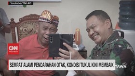 VIDEO: Sempat Alami Pendarahan Otak, Kondisi Tukul Kini Membaik