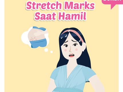 Stretch Marks Saat Hamil
