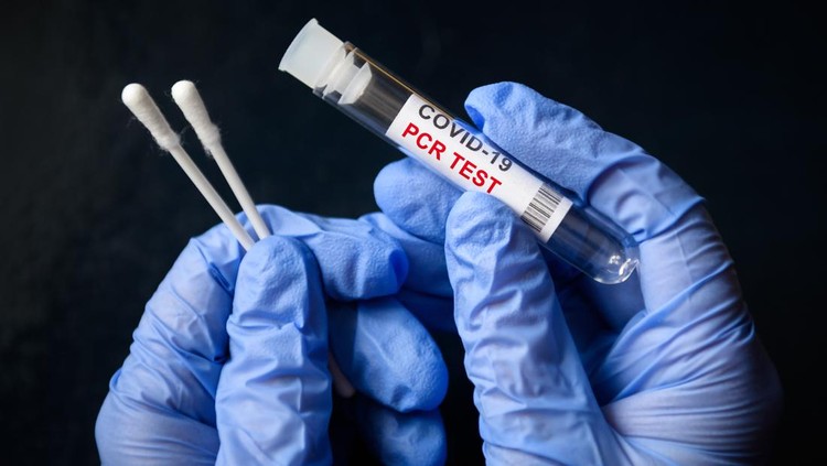 ilustrasi tes covid COVID-19 swab collection kit in doctor hands, nurse holds tube of coronavirus PCR test on black background. Concept of corona virus diagnostics, medical testing and cure during coronavirus pandemic.