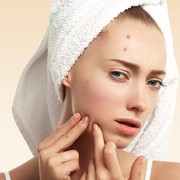 Cara Mengatasi Masalah Jerawat dari Beberapa Negara Asia, Ada yang Pakai Urine Sapi?