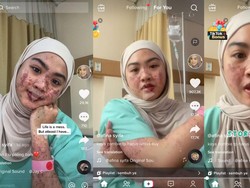 Viral Wanita Bekasi Ruam-Kulit Melepuh Sekujur Tubuh Usai Kena COVID-19