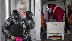 FOTO: Gadis Cilik di Mariupol Ukraina Tewas Akibat Serangan Rusia