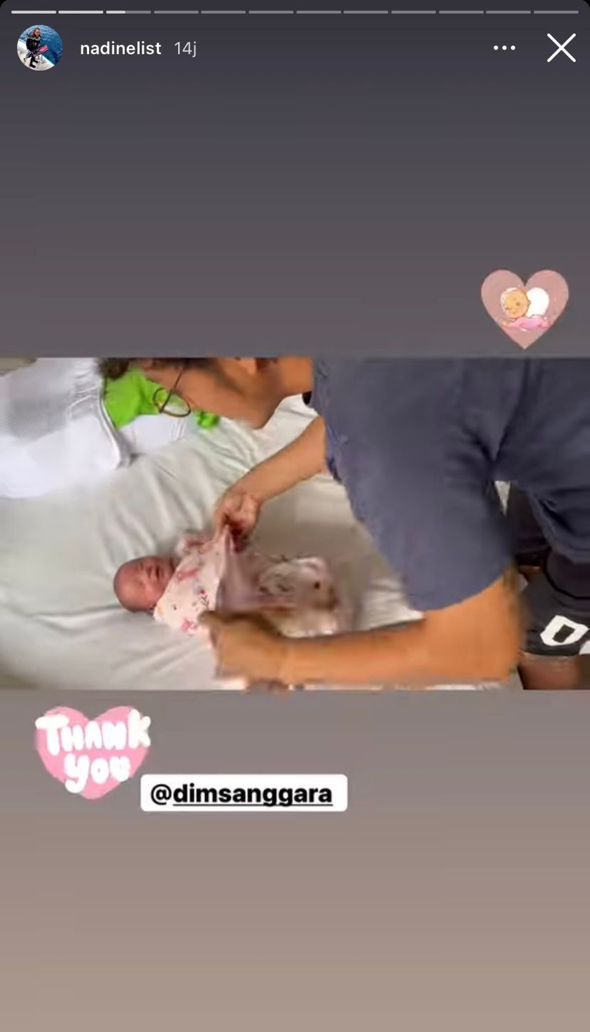 Nadine Chandrawinata dan Dimas Anggara dikaruniai anak perempuan dan resmi jadi orang tua&period; Yuk&comma; intip potret mereka momong baby Dijwa&excl;