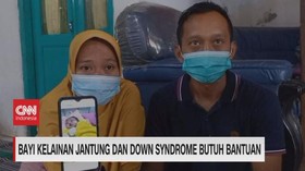 VIDEO: Bayi Kelainan Jantung & Down Syndrome Butuh Bantuan