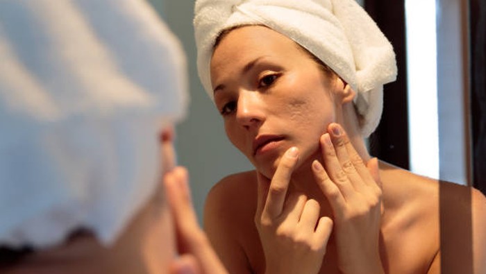 BeauPicks: Rekomendasi Skincare Ampuh untuk Para Pejuang Jerawat, Wajib Coba!