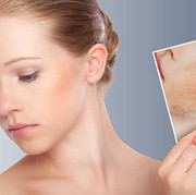 BeauPicks: Rekomendasi 4 'Calming' Serum untuk Kulit Sensitif dan Kemerahan