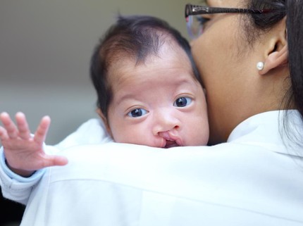 Tahapan Perawatan Ortodonti Anak dengan Bibir Sumbing
