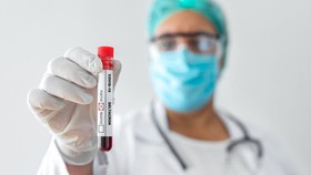 Epidemiolog RI Sebut Omicron Siluman BA.2 Potensi Bermutasi