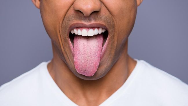 Warna lidah tertentu bisa menjadi gejala kolesterol tinggi. Hal ini berhubungan dengan stasis darah, kondisi yang dipicu oleh tingginya kadar kolesterol.