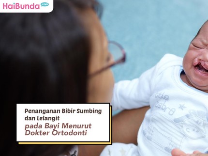 Penanganan Bibir Sumbing dan Lelangit pada Bayi Menurut Dokter Ortodonti