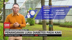 VIDEO: Penanganan Luka Diabetes Pada Kaki
