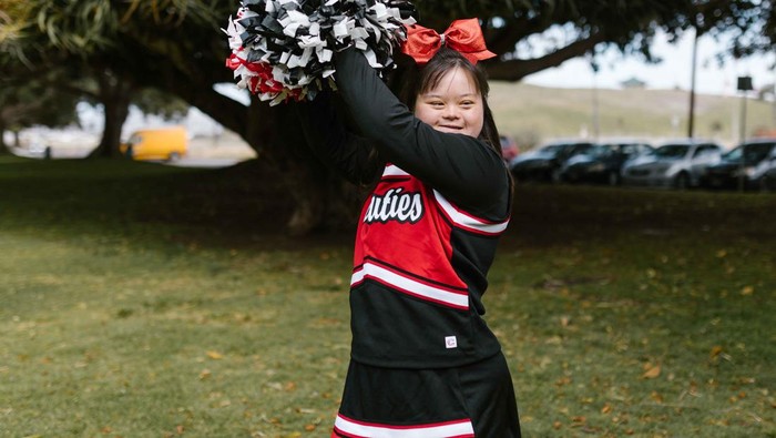 Hari Down Syndrome Sedunia 2022: Hal Seputar Down Syndrome yang Wajib Kamu Ketahui