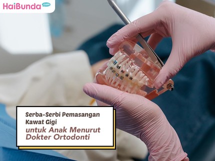 Serba-Serbi Pemasangan Kawat Gigi untuk Anak Menurut Dokter Ortodonti