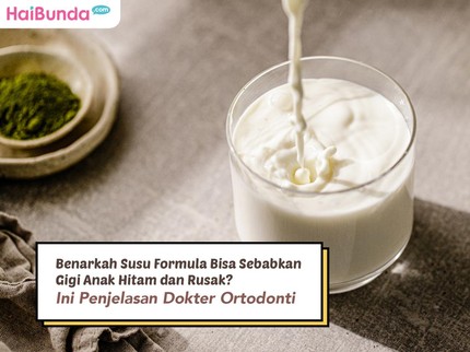 Benarkah Susu Formula Bisa Sebabkan Gigi Anak Hitam dan Rusak? Ini Penjelasan Dokter Ortodonti