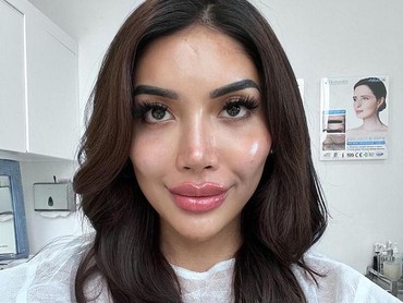 img-title Lucinta Luna Akui Operasi Plastik Ganti Kepala, Nama Millendaru Terseret